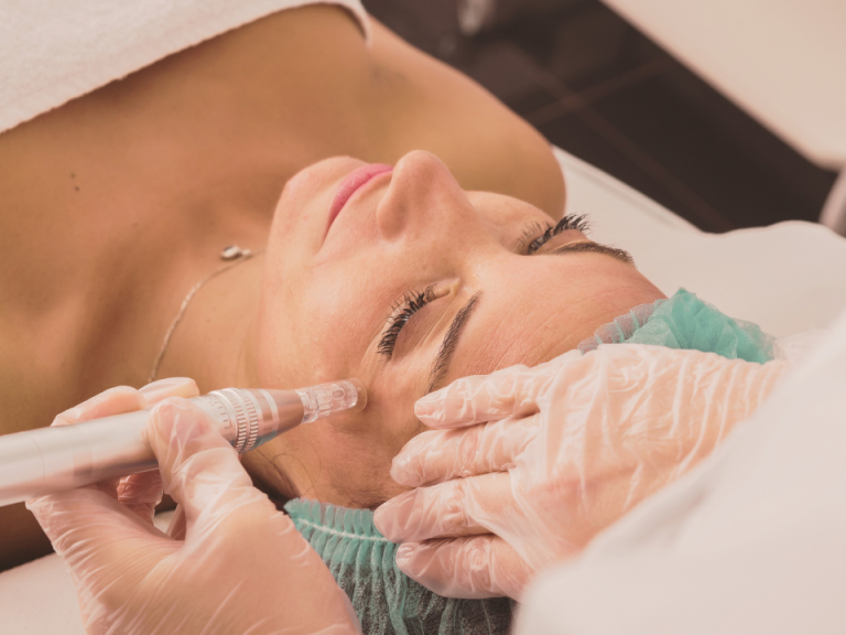 10 años de Ekoreka: microneedling a 80 € y sorteo doble